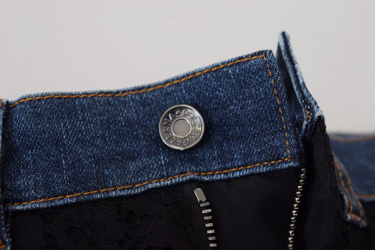 Bouton circulaire argenté dolce et gabbana sur jean skinny en denim bleu foncé avec dentelle florale noire